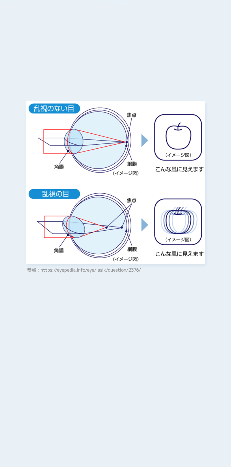 乱視用カラコン